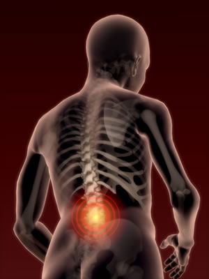 Posilňovanie hlbokého stabilizačného systému chrbtice